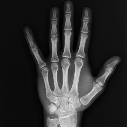 X-ray of hand and wrist