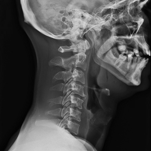 X-ray of spine very good quality.