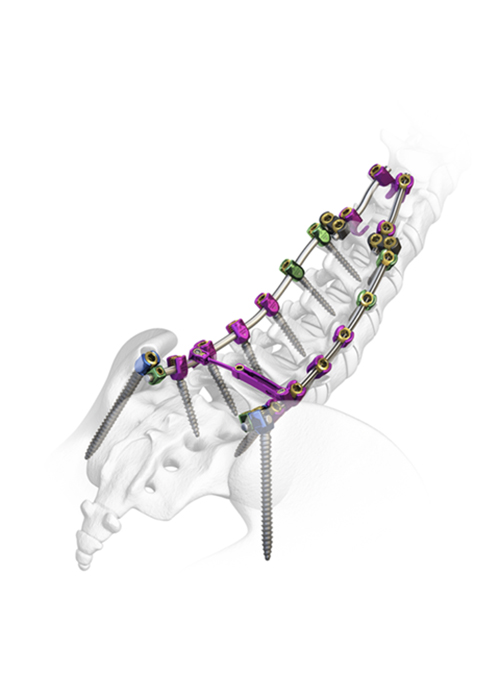 Spinal Elements Mercury System